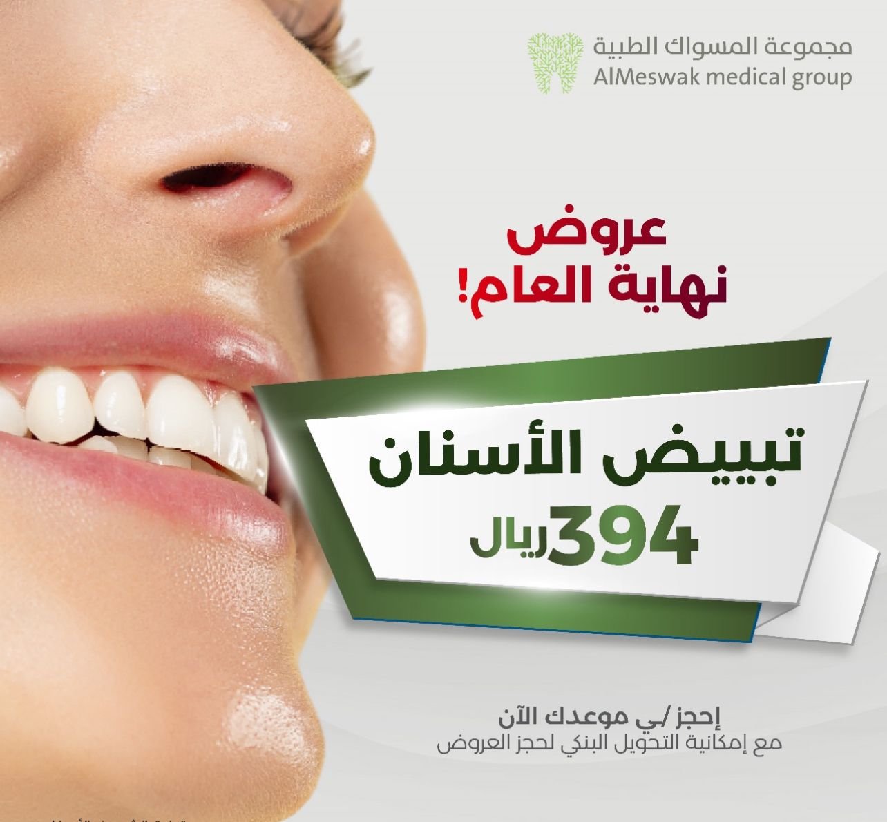 تبييض الاسنان